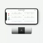 ALIVECOR KardiaMobile 6L 6-elvezetéses EKG