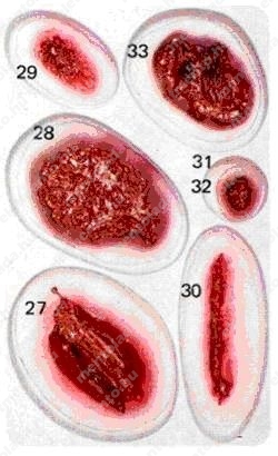 Practoplast sebimitációs készlet (33 seb)